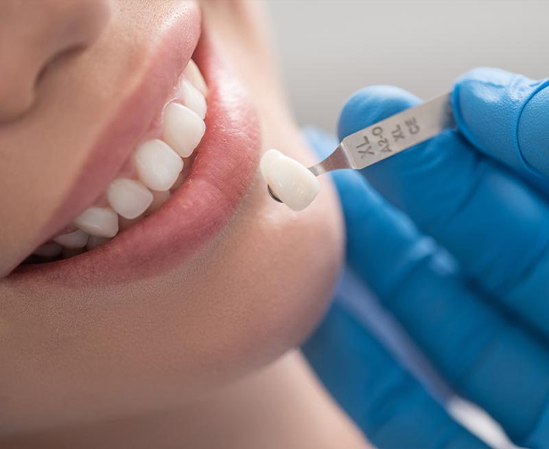 Woman getting dental bonding and implants